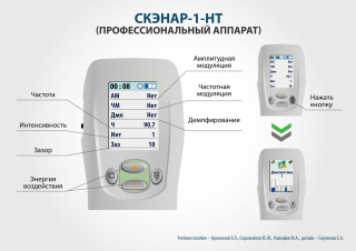 СКЭНАР-1-НТ (исполнение 01)  в Сухой Лог купить Медицинская техника - denasosteo.ru 